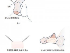 男性短小怎么变长变大