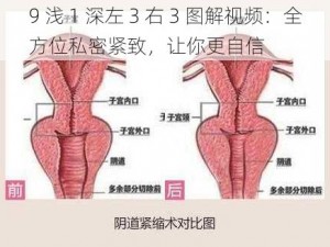 9 浅 1 深左 3 右 3 图解视频：全方位私密紧致，让你更自信