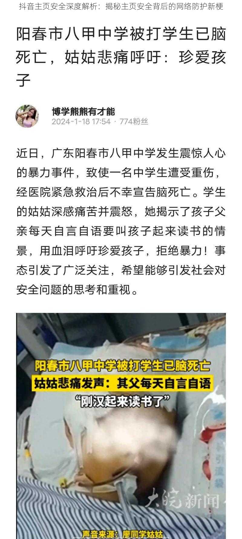 抖音主页安全深度解析：揭秘主页安全背后的网络防护新梗