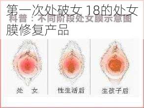 第一次处破女 18的处女膜修复产品