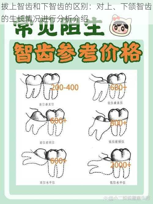 拔上智齿和下智齿的区别：对上、下颌智齿的生长情况进行分析介绍