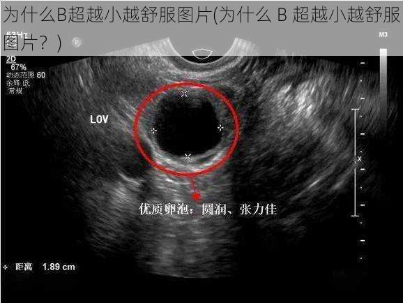 为什么B超越小越舒服图片(为什么 B 超越小越舒服图片？)